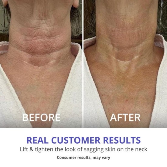 Neck Cream - Tighten & Lift Firming Neck Cream for Crepey Skin